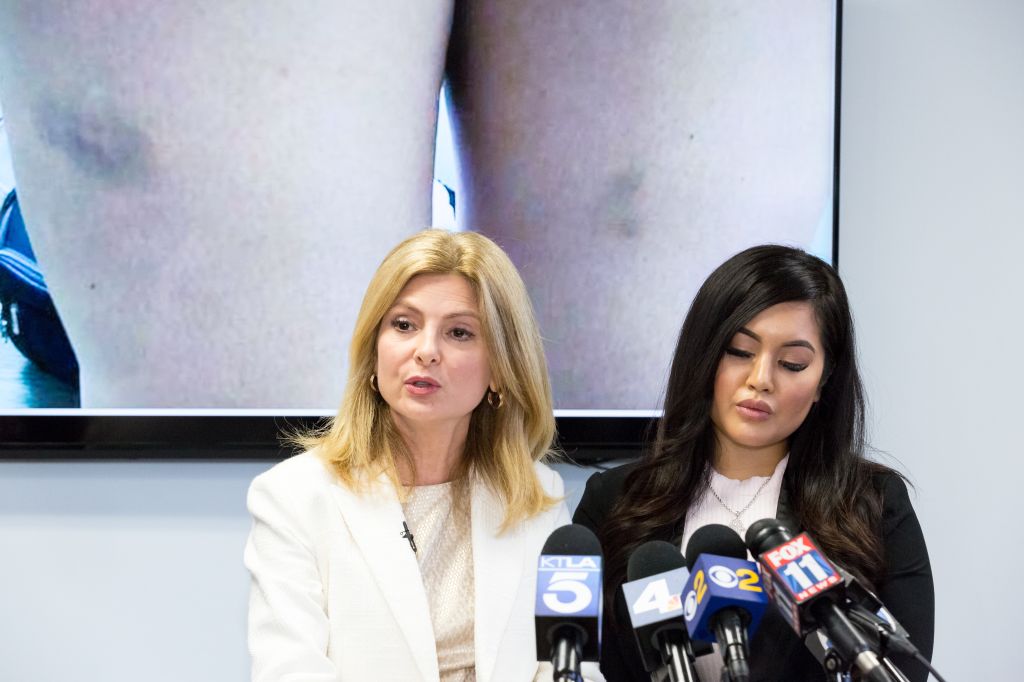 Lisa Bloom holds Press Conference With Andrea Buera Who Accused Trey Songz Of Assaulting Her